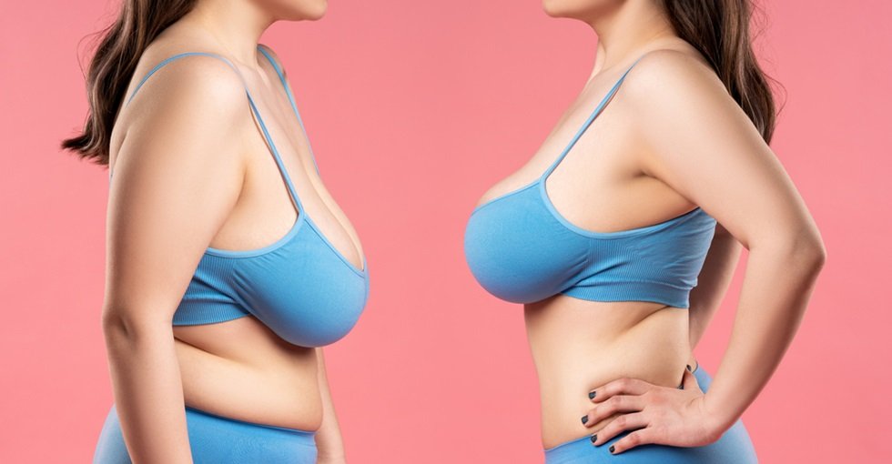 Breast Reduction Grand Prairie TX