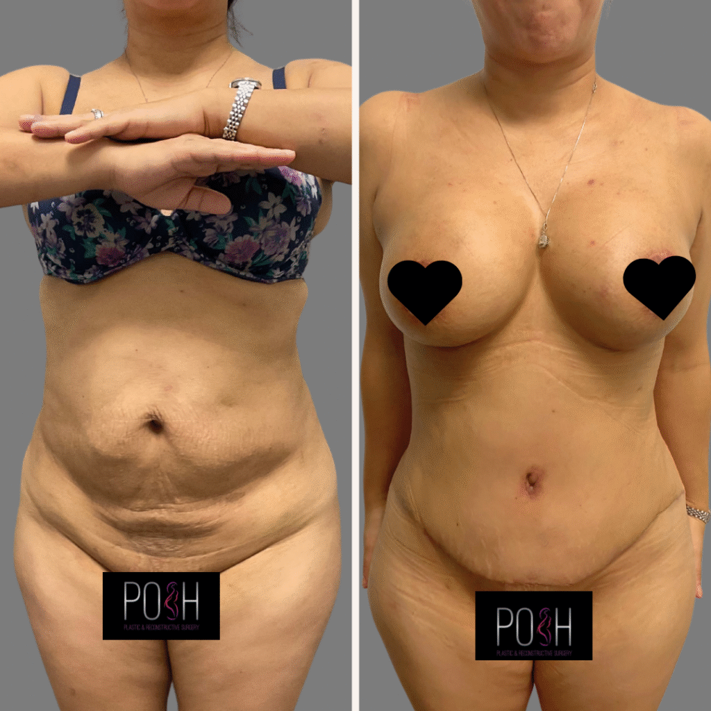 DR ROS 2104 After POSTED